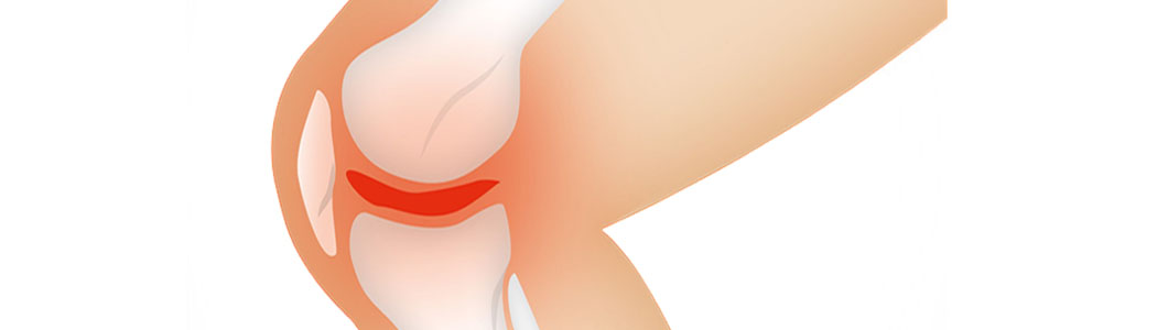 osteopathie-hamburg-die-knie-schmerz